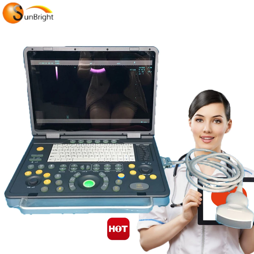 Portable laptop full digital B model ultrasound machines