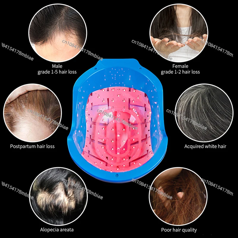 USB перезаряжаемая машина для лечения выпадения волос 272 диодов 678 нм длина волны