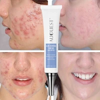 20g effective acne removal cream remove acne scar acne treatment gel anti acne pimple oil control moisturizing smooth skin care