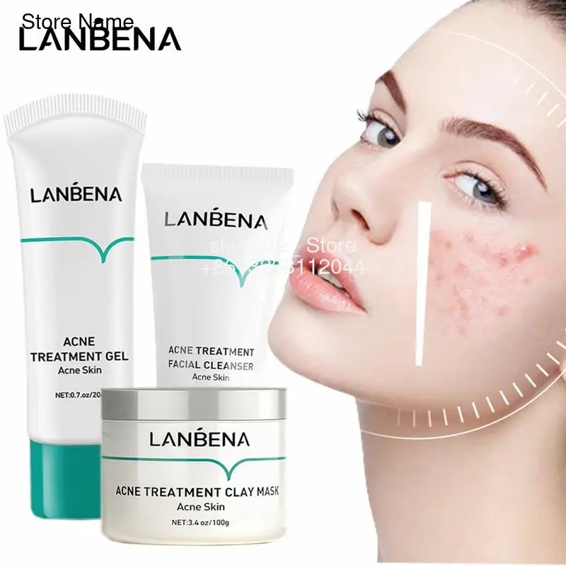 

LANBENA Acne Treatment Serum Facial Cleanser Cleansing Mask Anti Acne Oil Control Remove Acne Marks Inflammation Acne Skin Care