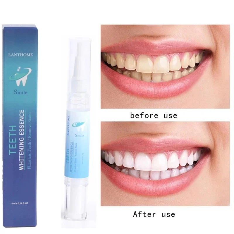 

Teeth Whitening Pen Tooth Gel Whitener Bleach Remove Stains Instant Smile Cleaning Gel Fresh Breath Whiten Teeth Cleaning Serum
