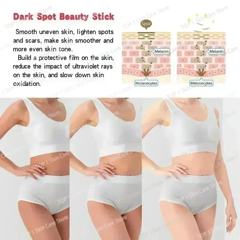 Горячие продажи отбеливающий крем для удаления темных пятен и корректора нежный