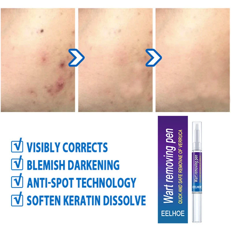 Рисунок 6 - Новинка, средство для удаления бородавок