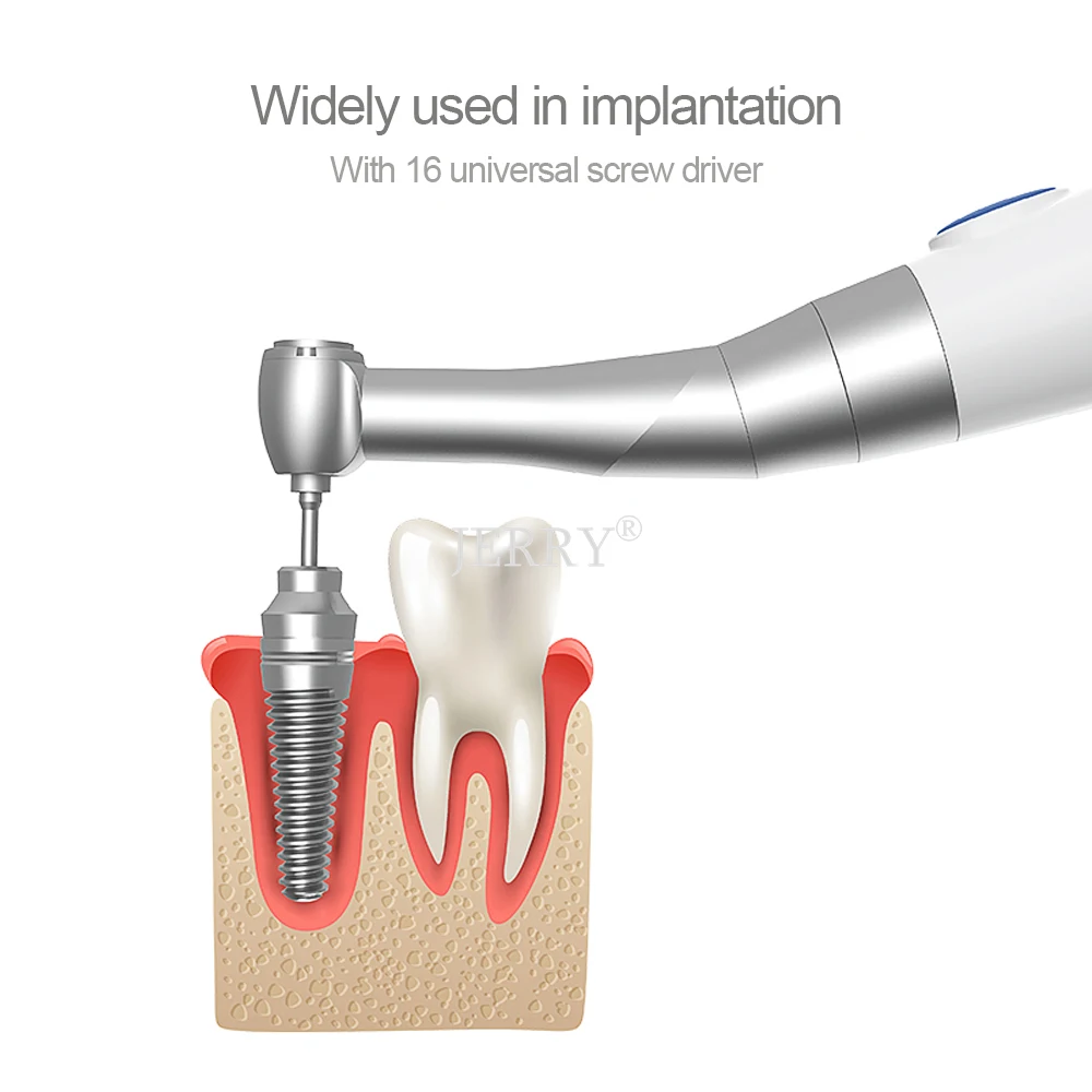 d ental lant Трещотка и динамометрический ключ 10-50 Ncm Реставрация Универсальный imp