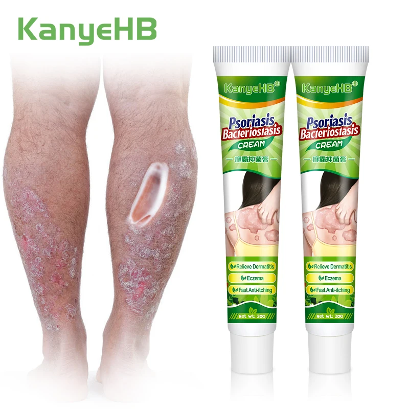 

2pcs Psoriasis Anti-itching Cream Relief Eczema Dermatitis Urticaria Desquamation Pruritus Bacteriostatic Medical Plaster A1054