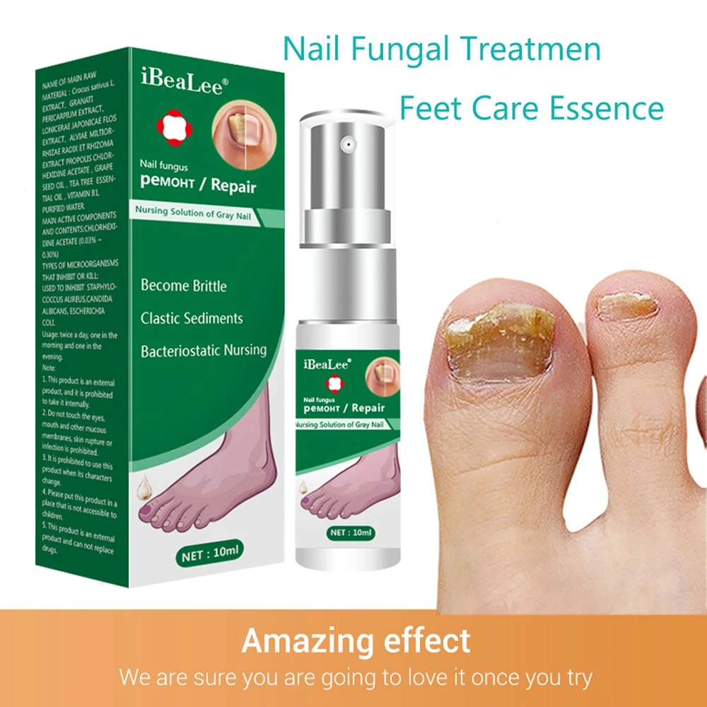 

Nail Fungus Serum Honeysuckle Extract Stimulates The Production of Cellular Proteins Healthy Growth Fungal Antibacterial Hot