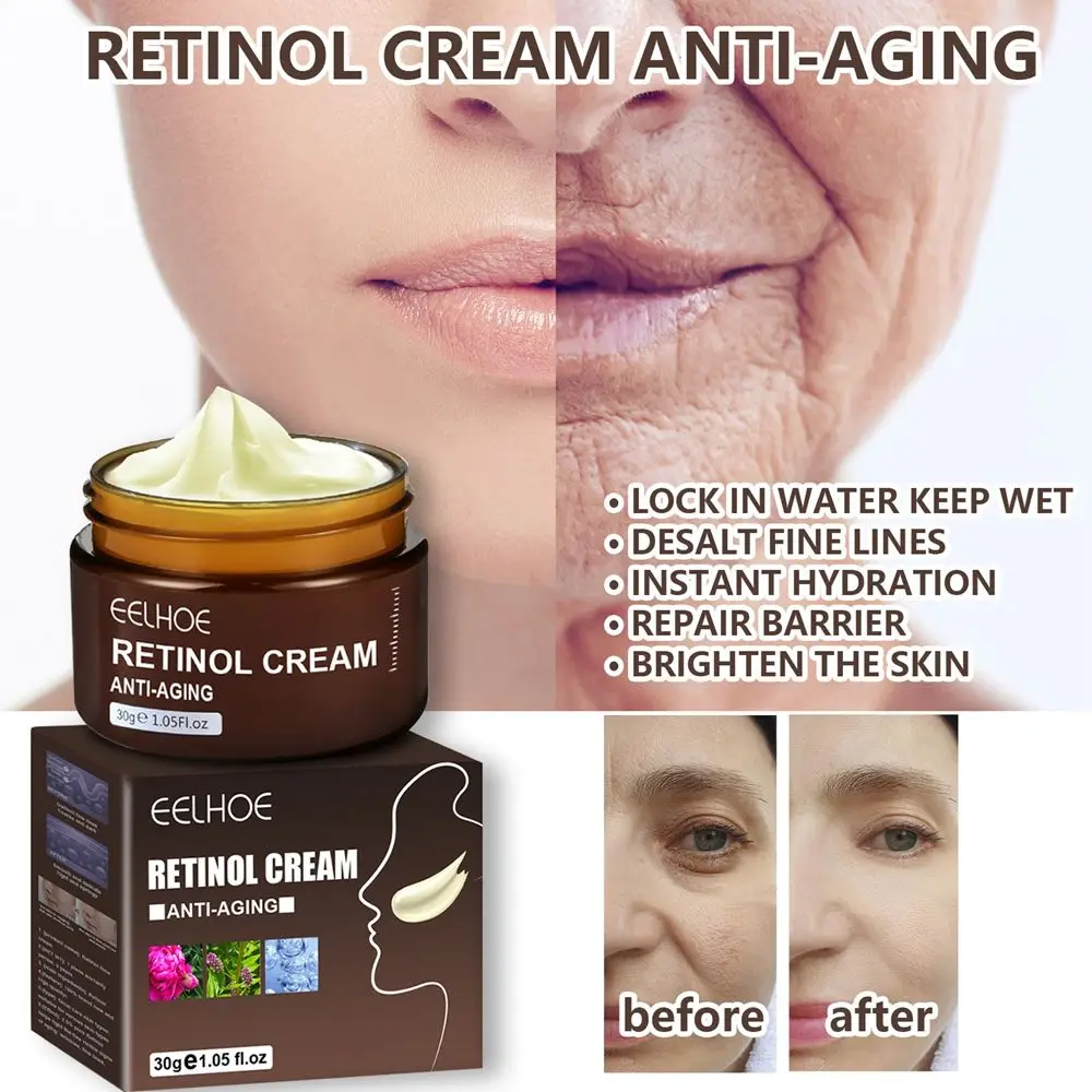 

Retinol Whitening Cream Removes Melasma Acne Remover Anti Aging Moisturizing Face Cream Face Skin Care Hyaluronic Acid Firming C
