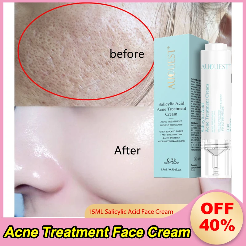 

15ML AUQUEST Salicylic Acid Acne Treatment Face Cream Anti-acne Gel Shrink Pores Moisturizing Serum Remove Blackheads Skin Care