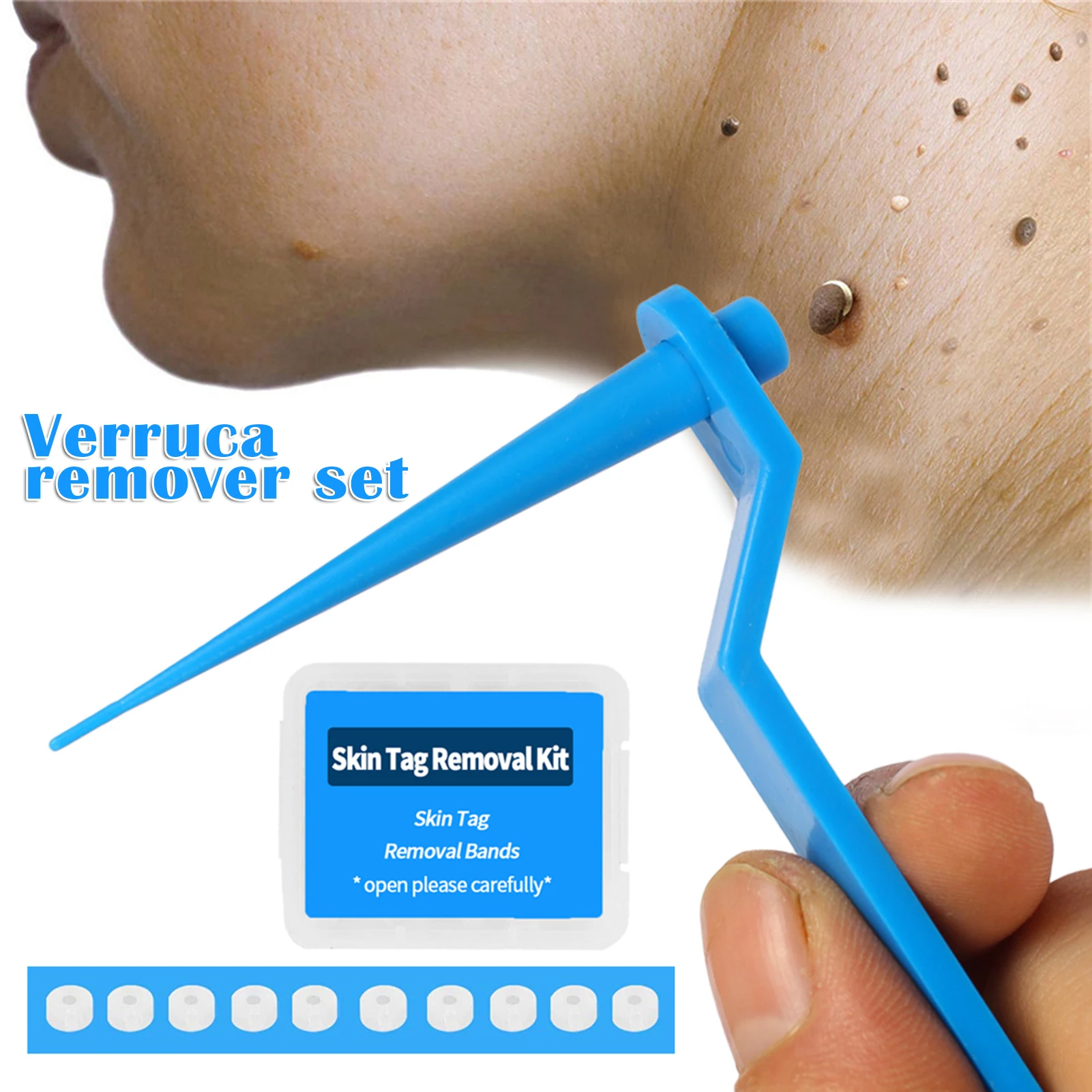 

Convenience Skin Tag Remover Device Set Mole Wart Remover Device For 2-5mm Acne Remover Treatment Body Skin Beauty Care Tools