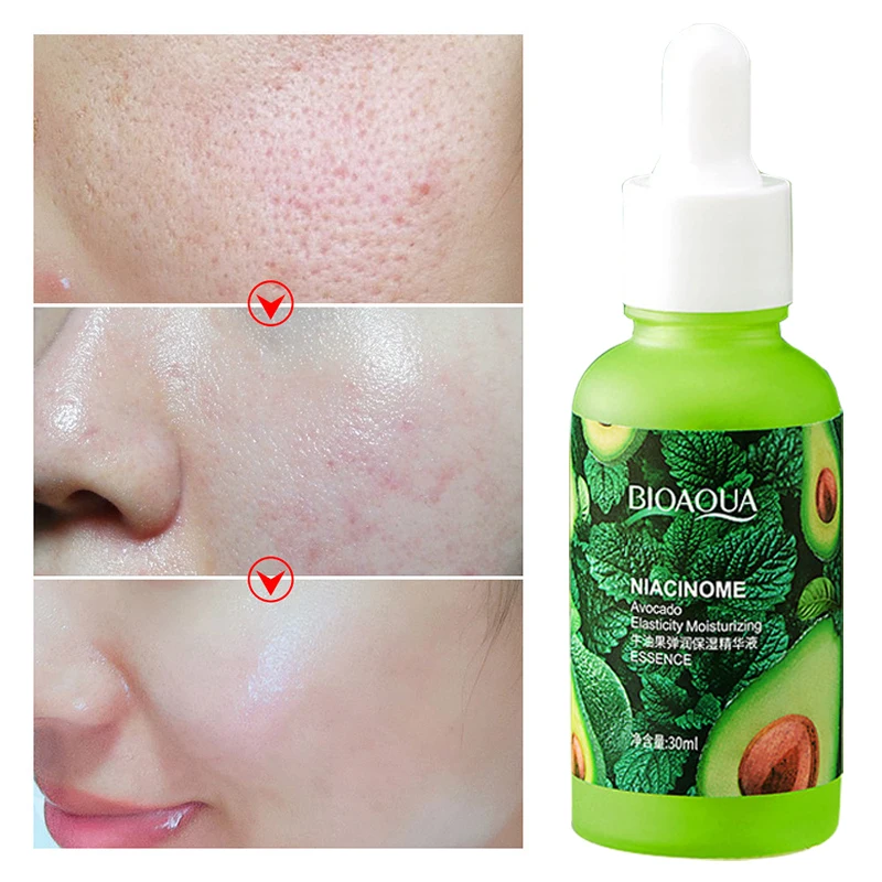 30ml Face Serum Avocado Moisturizing Hydrating Brightening Shrinking Pore Refreshing Essence Facial Skin Care