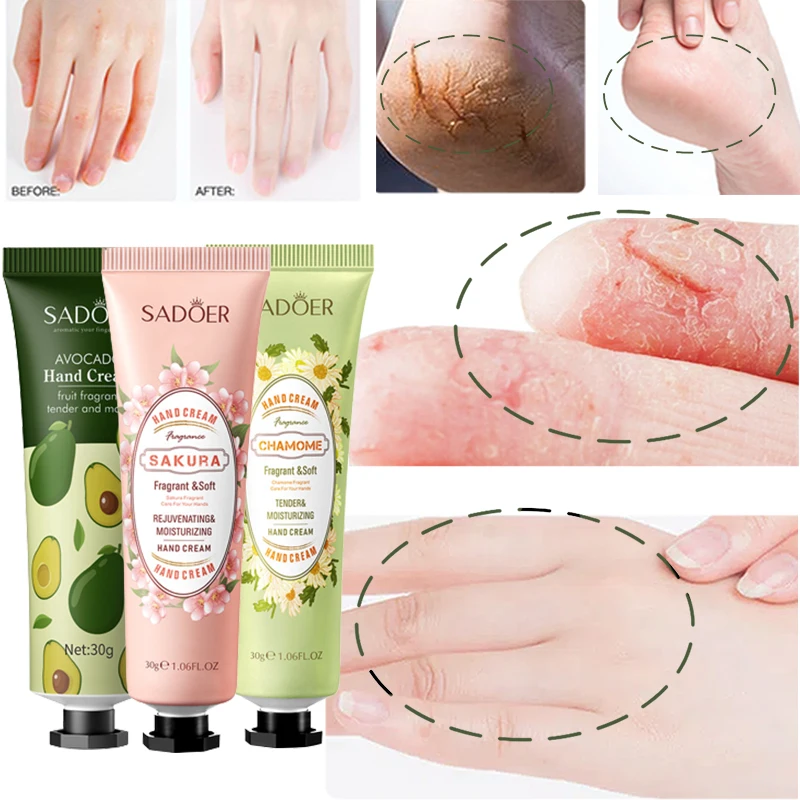 

5Pcs Plant Fragrance Hand Cream Set Repair Dry Anti-Frozen Hand Lotion Exfoliating Remove Hydrating Moisturizing Hands Skin Care
