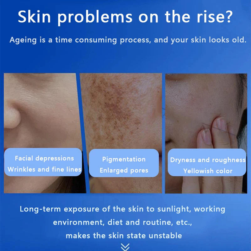 Фото Набор для ухода за кожей: 80% спикул морских водорослей, микрокристаллы, натуральный биологический экстракт, восстановление лица, лечение акне №3