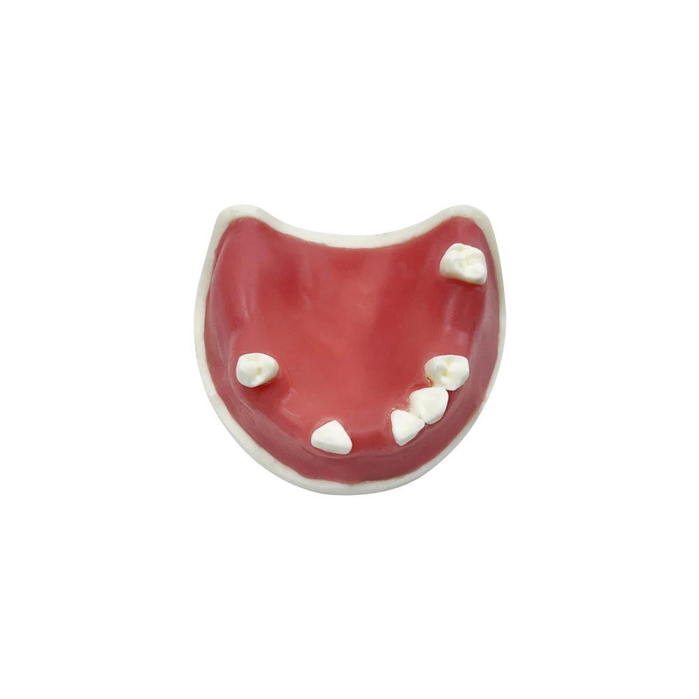 Модель зубного имплантата реставрация зубов обучающая учебная модель Typodont с