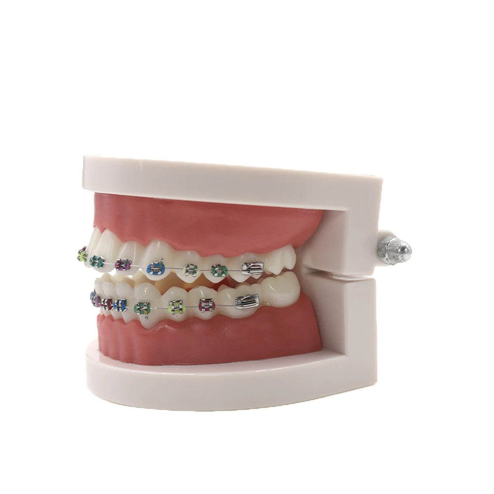 

Dental Teach Study Adult Typodont Demonstration Teeth Model with Brackets