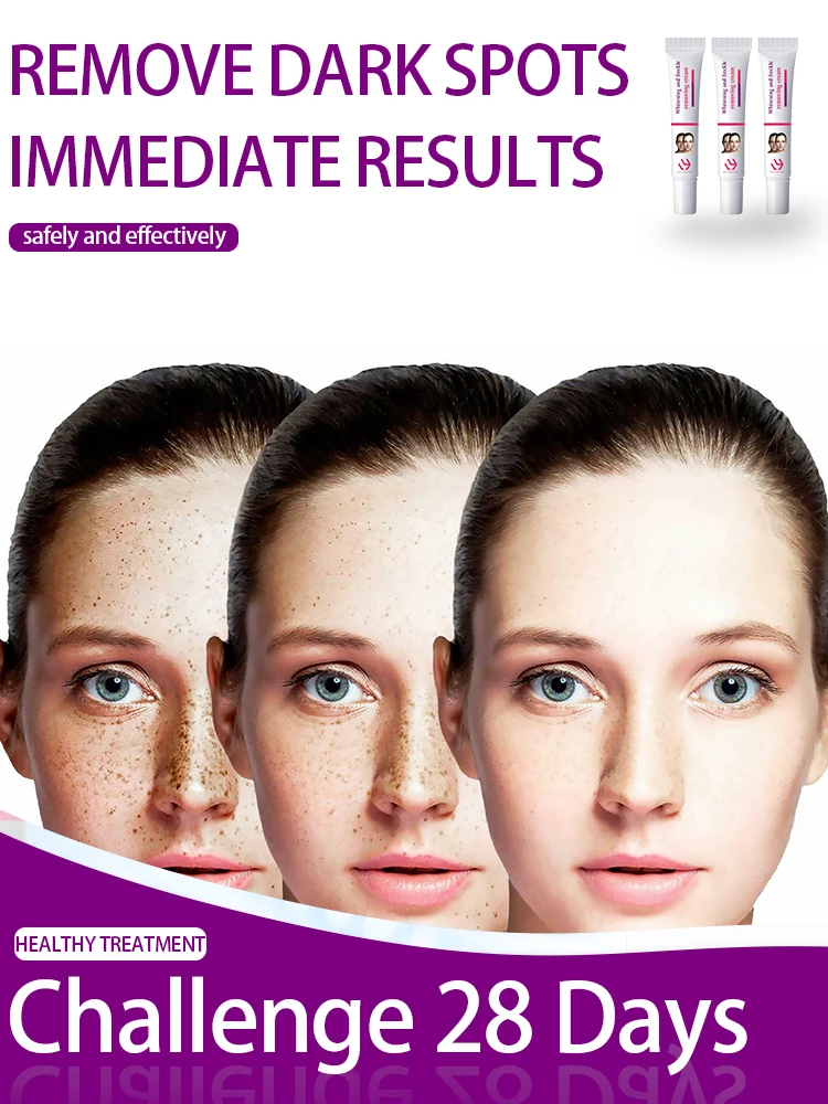

Freckles Removal Cream Remove Facial Spots Turmeric Dark Spot Removal Melasma Age Spots Sunspots Whitening Freckle Cream Remover