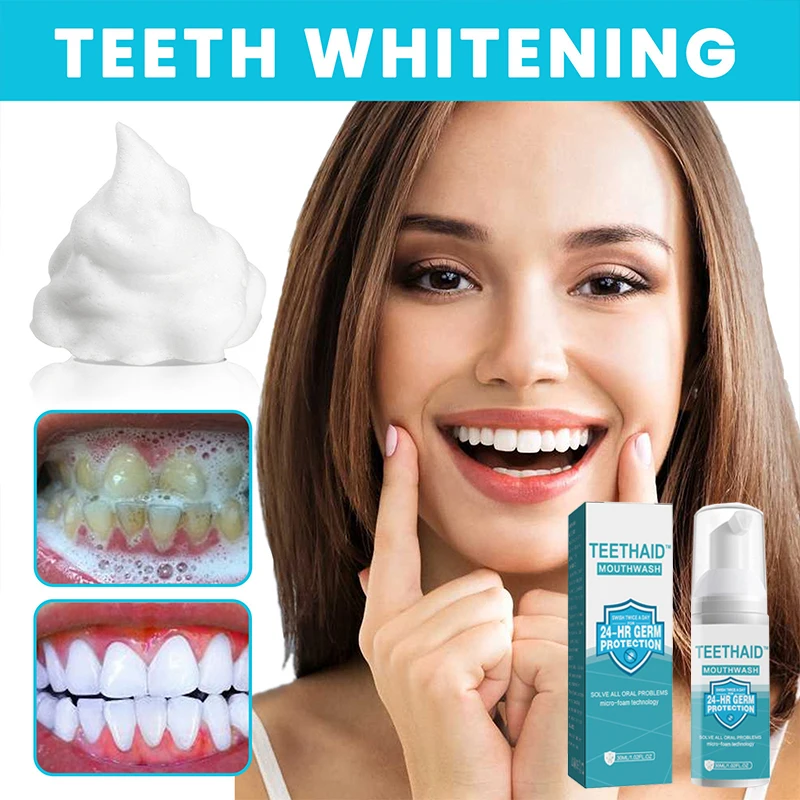 

Новинка, средство для чистки зубов, мусс для удаления пятен, эссенция для гигиены полости рта, стоматологический мусс, инструменты для чистки, зубная паста для взрослых