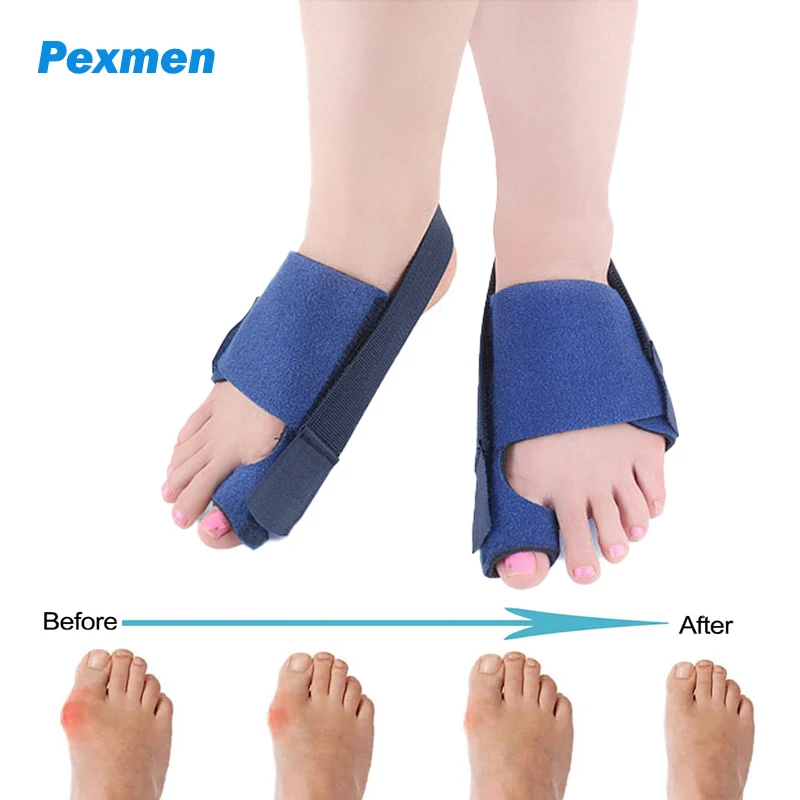 

Pexmen Bunion Corrector Bunion Splint Adjustable Bunion Relief Brace Big Toe Straightener for Hammer Toes Hallux Valgus