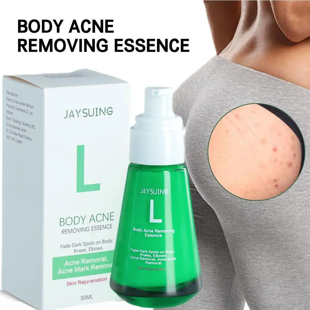 

Body Acne Serum Acne Removal Serum Cream Fade Acne Marks Caring For The Skin Skin Care Supplies Y7E1