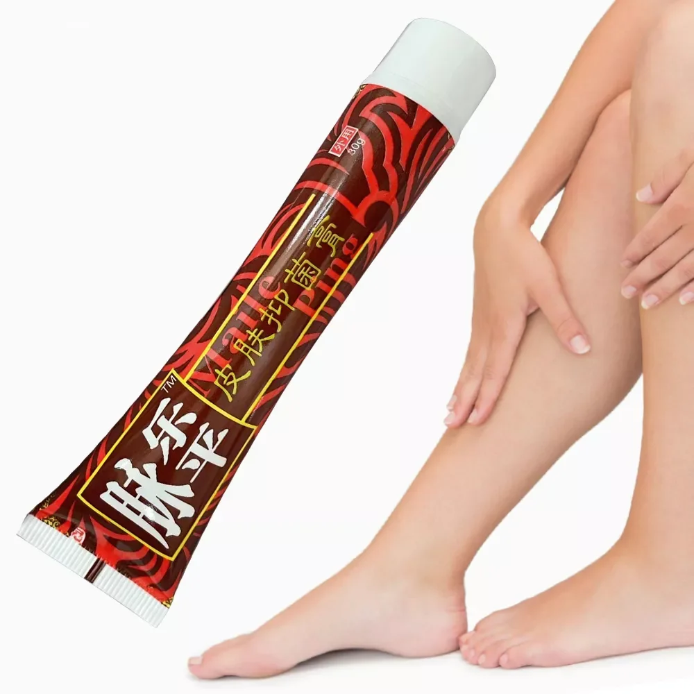 Лечение Варикозного расширения вен варикозное ангиитное средство мазь для