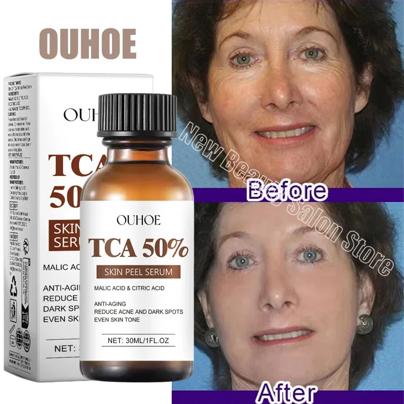 TCA 50% сыворотка для лица удаления морщин укрепляющая лифтинговая антивозрастная