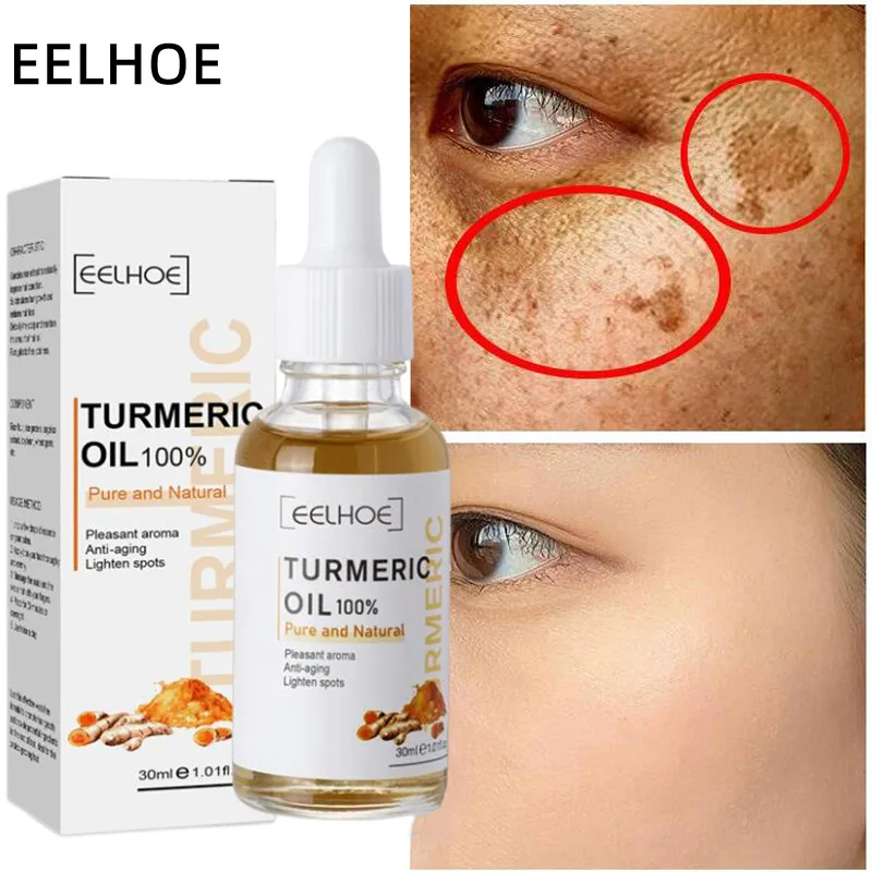 

Куркума отбеливание веснушек сыворотка куркумин масло осветляет выцветание темные точки пигмент меланин коррекция красоты уход за кожей л...