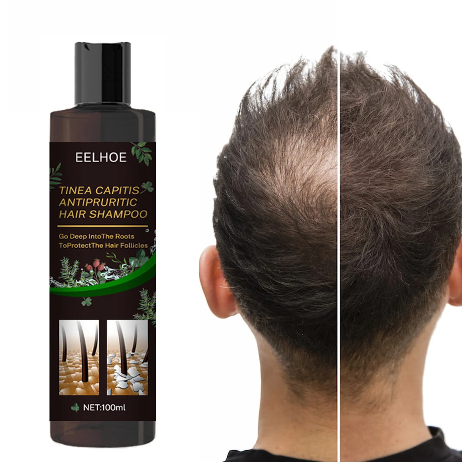 

100ml Antipruritic Shampoo Nourishing Repairing Refreshing Oil Control Anti Dandruff Anti Split Ends Smooth Silky Hair Shampoo