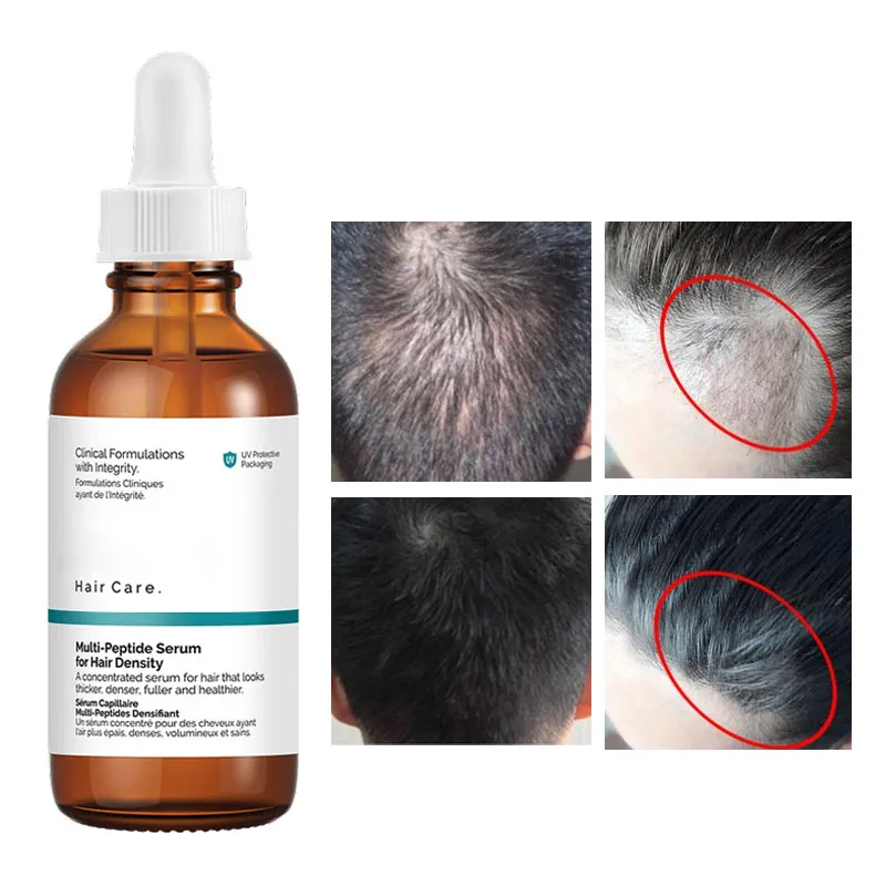 Multi-Peptide Serum For Hair Density Hair Growth Bushy Health Strength Polypeptide Scalp Serum Hair Care 60ml