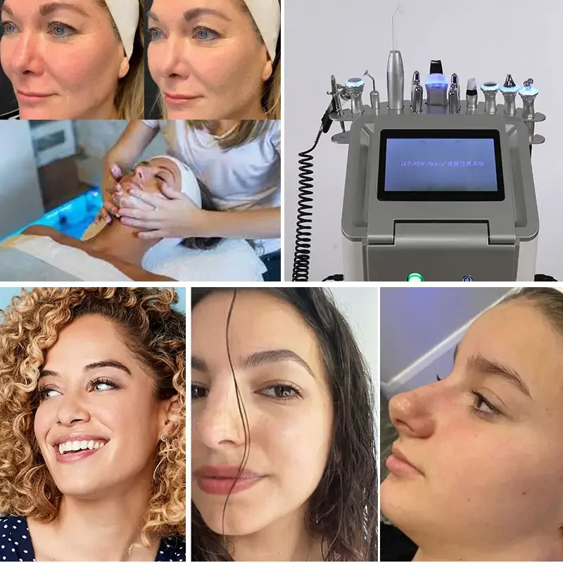 Рисунок 5 - 10 в 1, аппарат для удаления черных