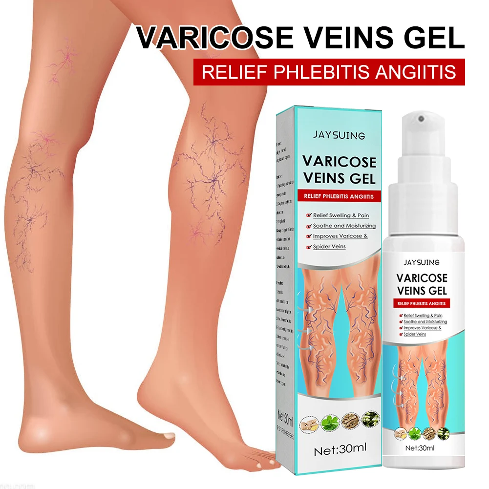 

30ml Varicose Veins Treatment Gel Leg Swelling Pain Relief Varicosity Angiitis Varicose Vein Removal Gel Health Care Massage Gel