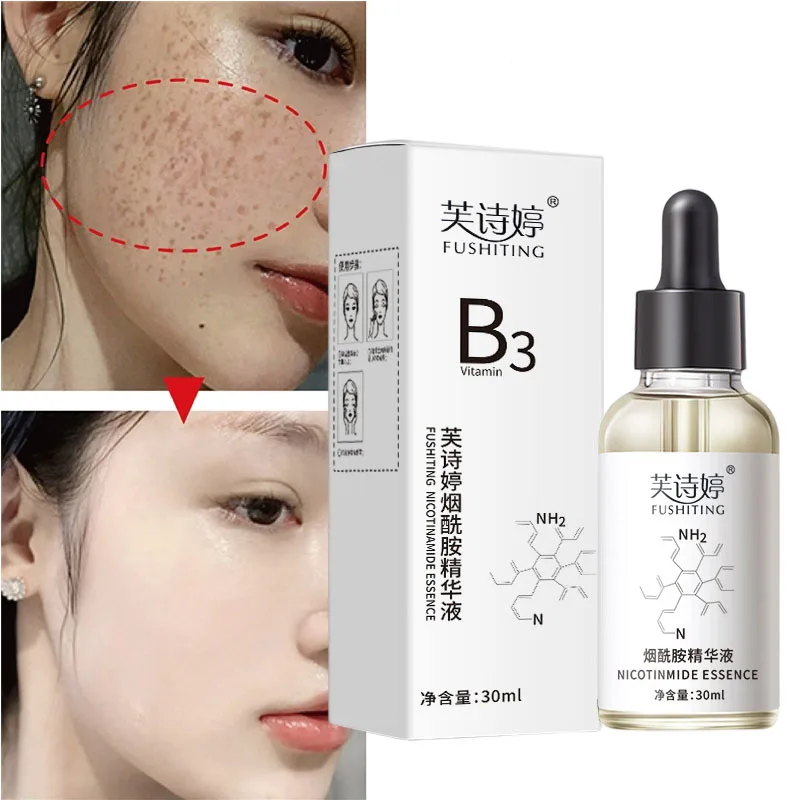 

Nicotinamide Whitening Serum Fade Dark Spots Freckles Brighten Essence Remove Pigment Melanin Correcting Beauty Facial Skin Care