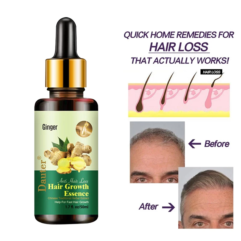

Ginger Hair Growth Essential Oil Serum Hair Treatment Anti Lost Beauty Products Fast Grow Repair Scalp Frizzy Damaged Hair Care