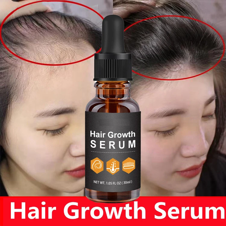 

Hair Growth Serum Ginger Essence Oil Fast Hair Grower Hair Treatment Agent Effective Hair Regrowth Hair Care Essential Oil