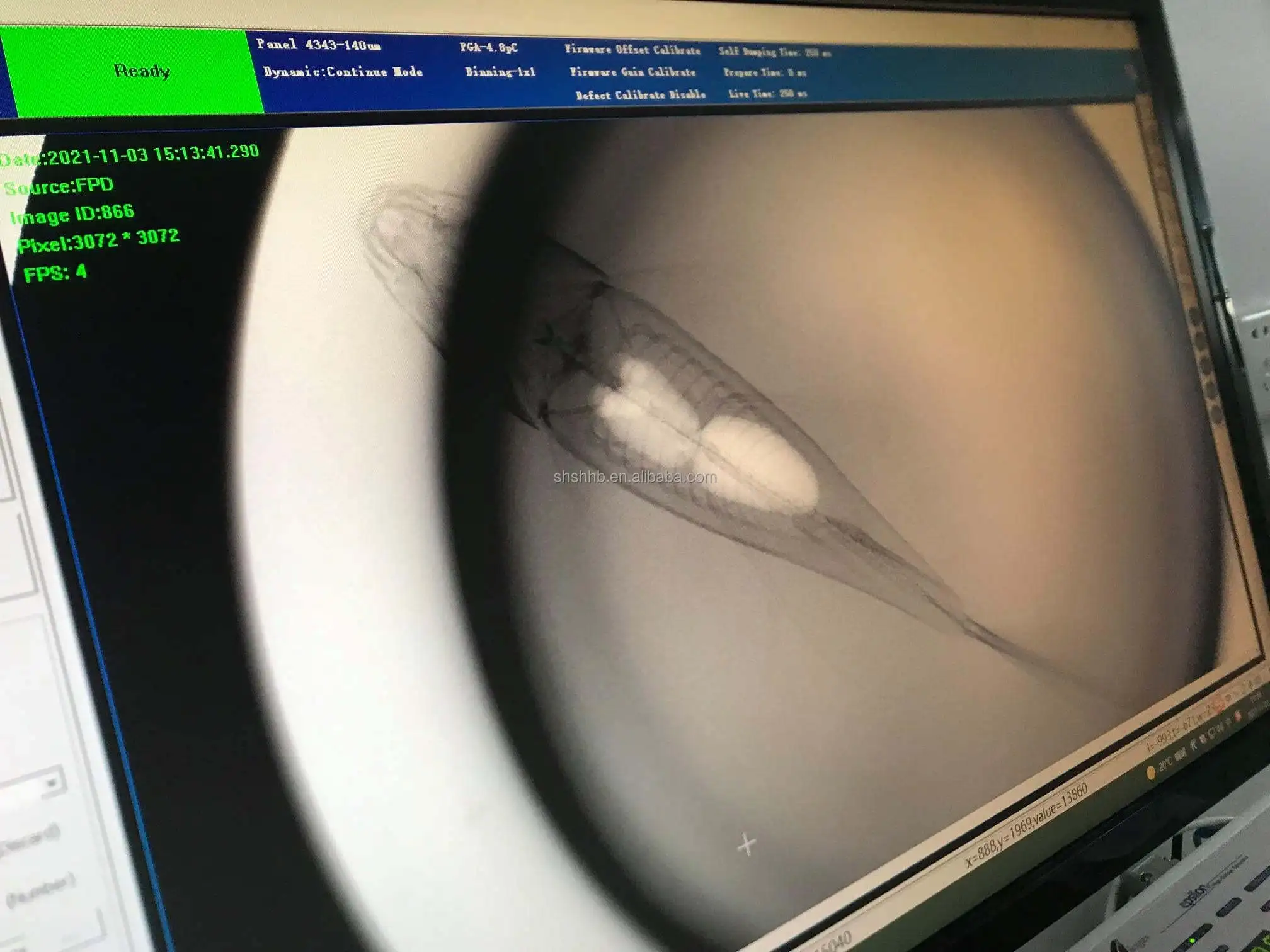 Рисунок 6 - Детектор рентгеновских снимков