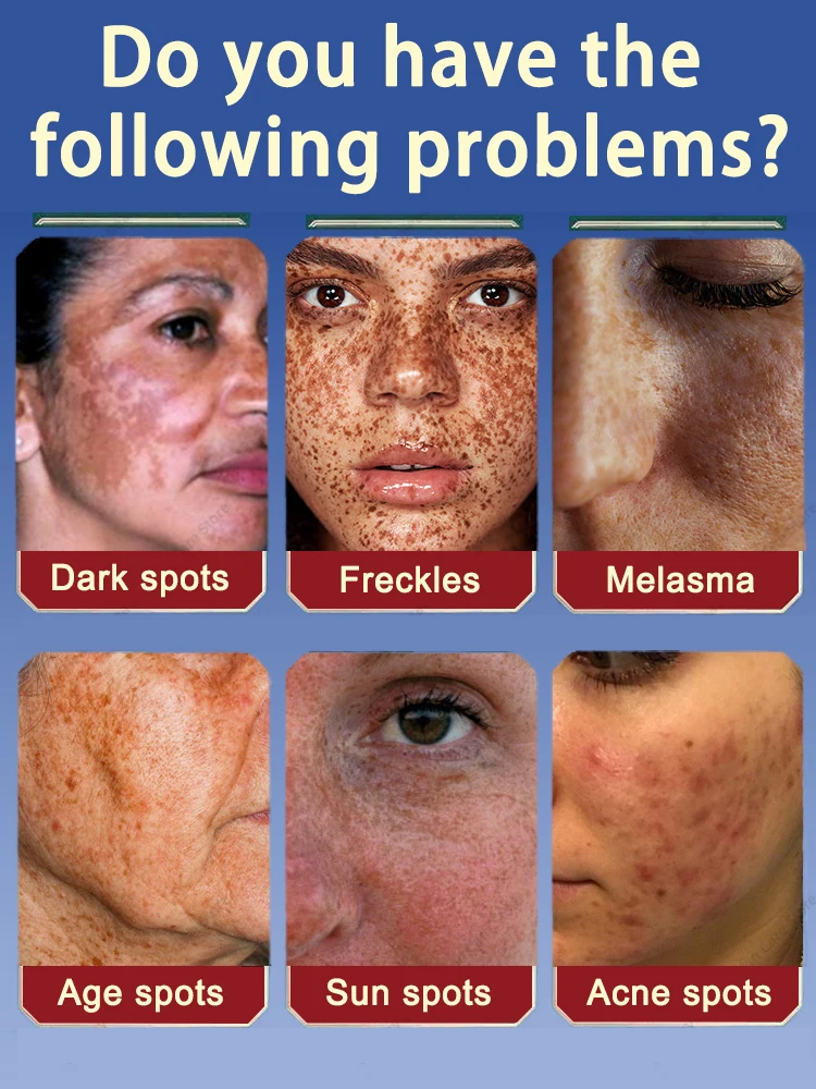 afe и быстрое удаление темных пятен