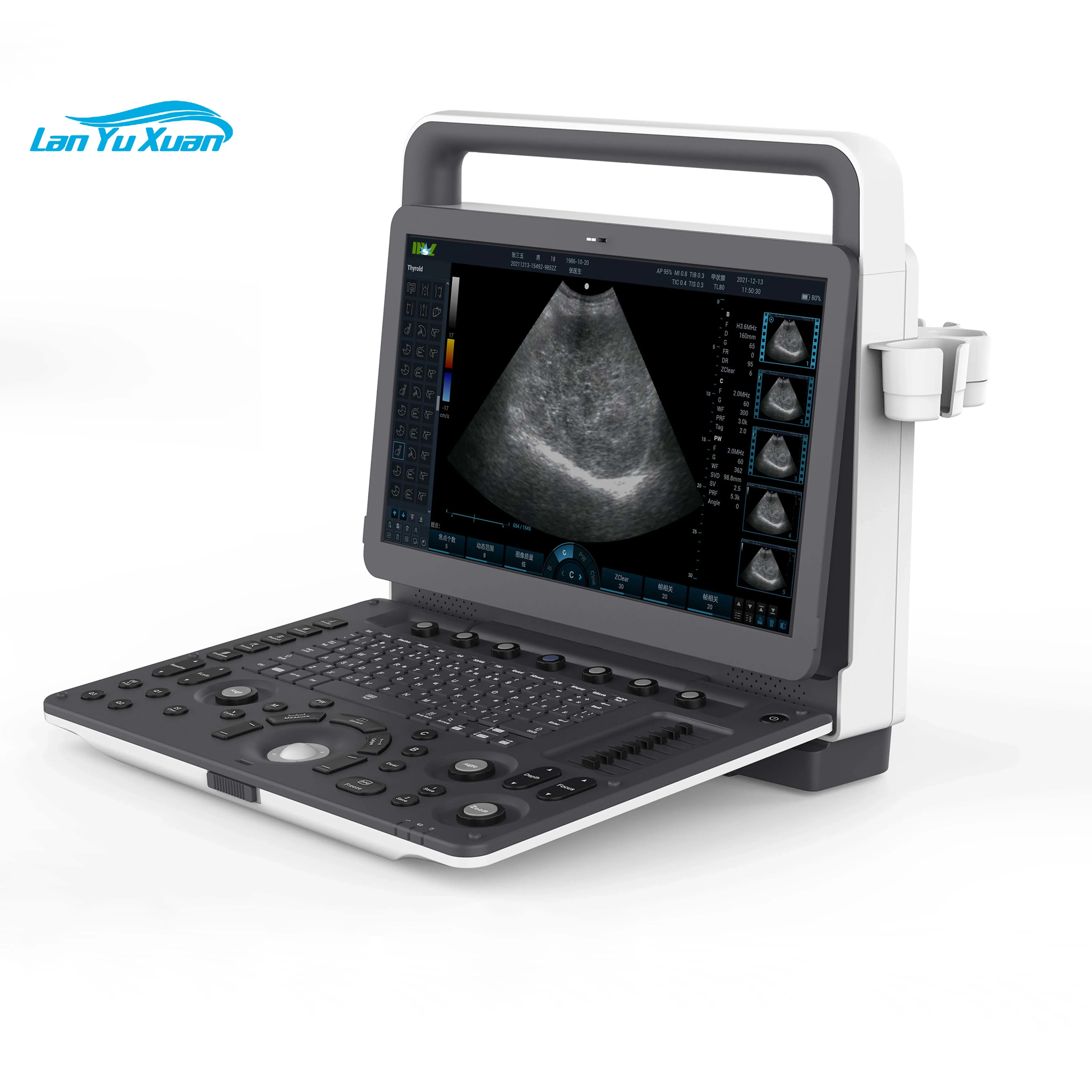 Рисунок 3 - Портативный ультразвуковой допплер