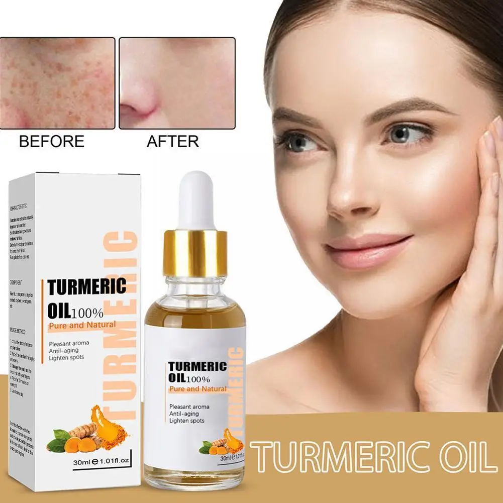 

30ML Turmeric Freckle Whitening Serum Fade Dark Spot Care Beauty Pigment Removal Skin Correcting Facial Face Essence G5J7