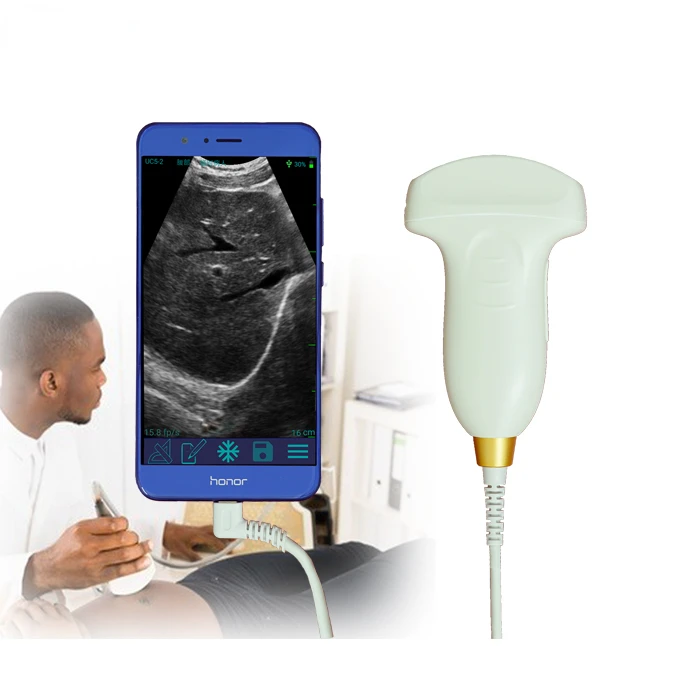 SUN-P1 ультразвуковой аппарат дисплей USB выпуклый зонд смартфон компьютер цена