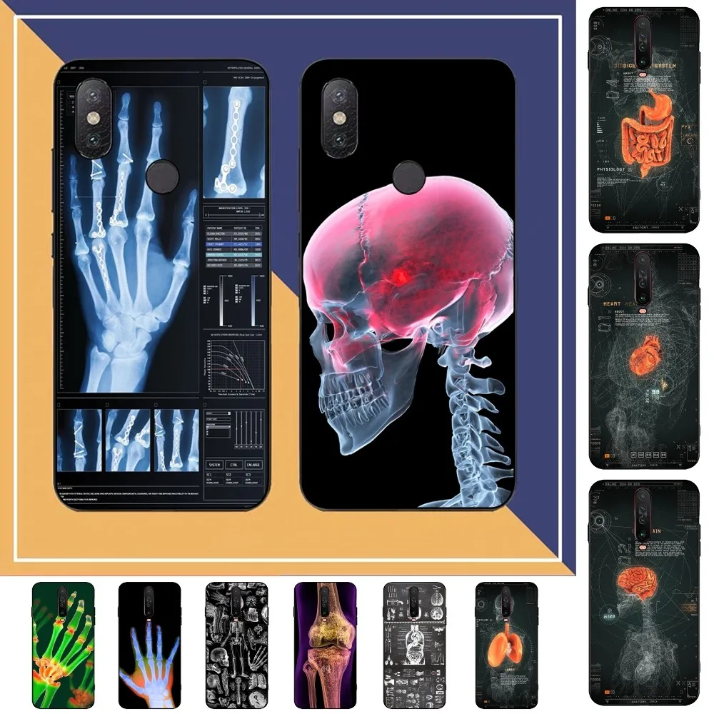 Радиологический каркас человеческих органов телефон планшетофон X 5 A 6 7 8 Pro T9 9S 10 11