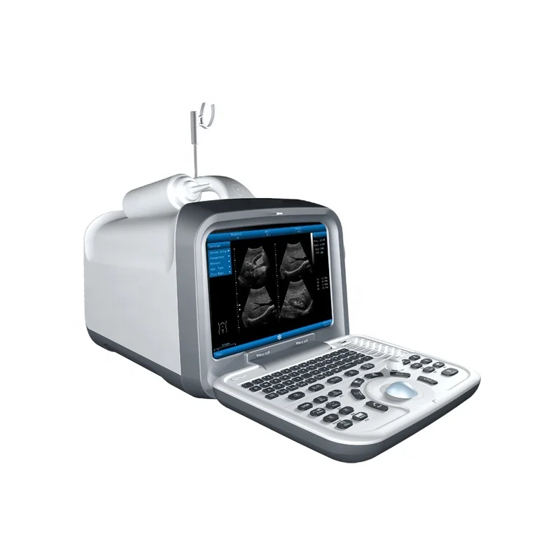 

Innovative Ergonomic Design Medical Ultrasound Scanner Machine Clinic For Pregnant Women