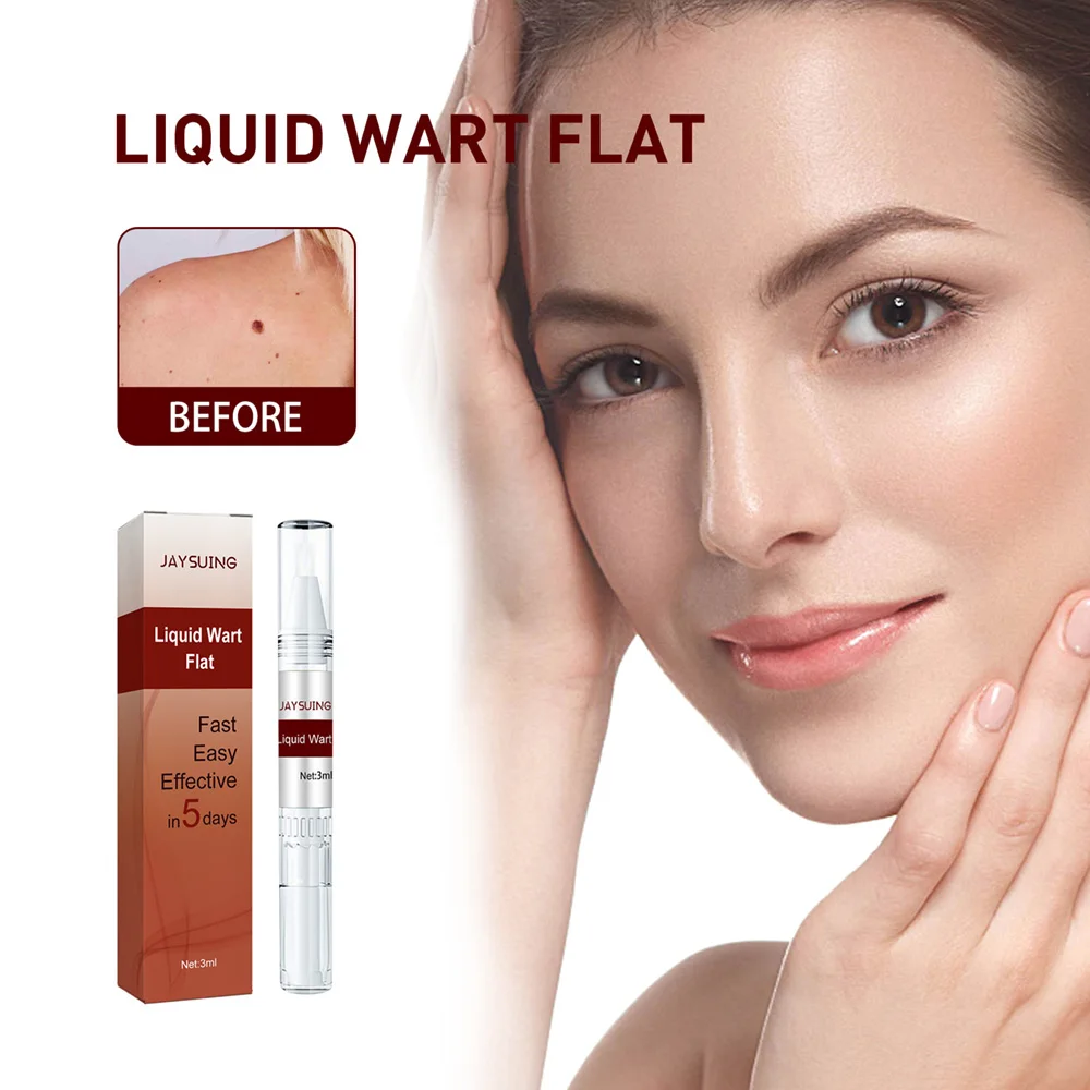 

Removing Against Moles Liquid Pen Mole Skin Tag Black Dots Fast Remover Liquid Painless Treatment Face Body Dark Spot Removal