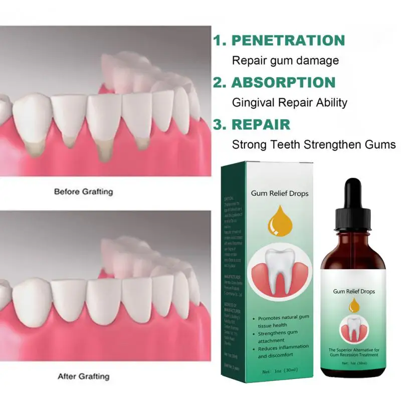 

Gingival Regrowth Drops Quickly Repair Of Cavities Caries Mousse Gum Treatment For Receding Gums Rejuvenate Your Gums With Ease