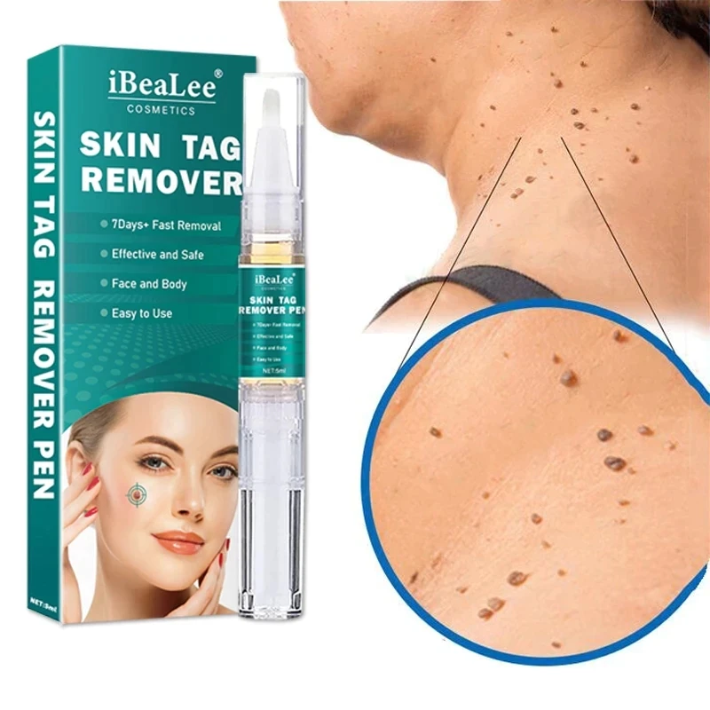 

iBeaLee Skin Tag Remover Pen Painless Fast Dark Spot Mole Warts Removal Serum Freckle Face Flat Wart Tag Treatment Essential Oil