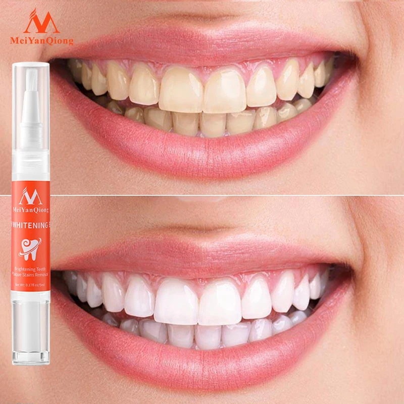 MeiYanQiong Teeth Whitening Pen Bleaching Dental Remove Plaque Stains Oral Hygiene Cleaning Serum Tooth Brightening Care Essence