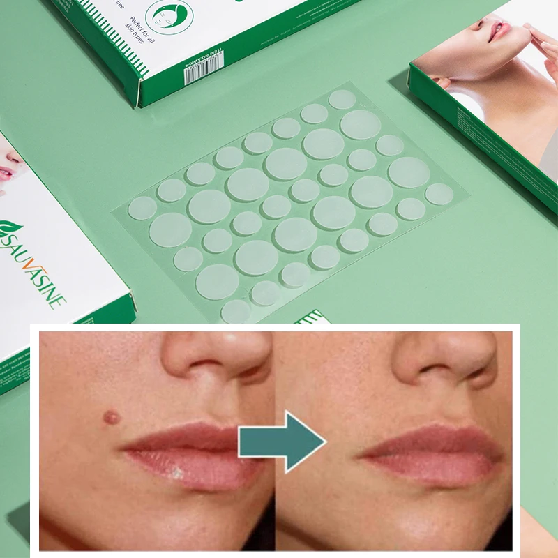 

72PCS Medical Plaster Foot Corn Removal Warts remover Thorn Patches Corn Medical Patch skin tag and moles removal patch