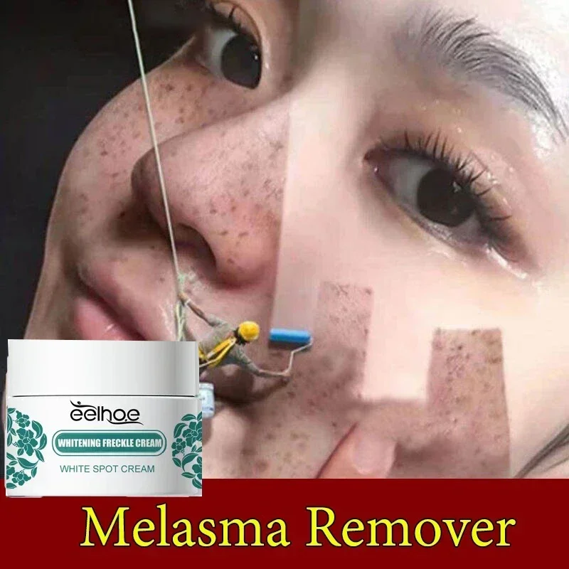 ГОРЯЧАЯ ПРОДАЖА отбеливание темной кожи удаление темных пятен веснушки