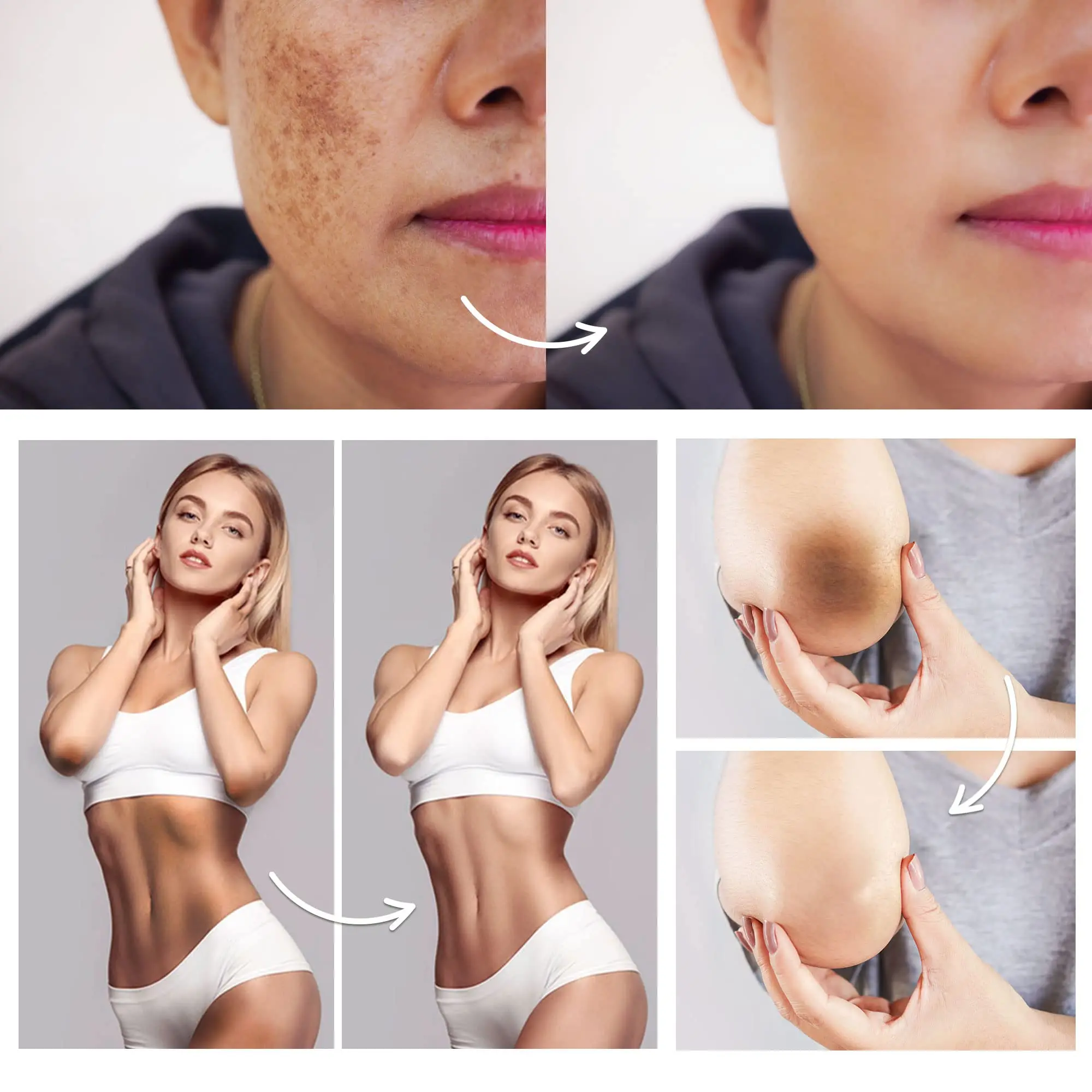 Фото Отбеливающий крем для интимной зоны, осветляющий кожу, подходит для всех частей тела, пигментация, средство для удаления мелазмы, отбеливающий крем для тела №5