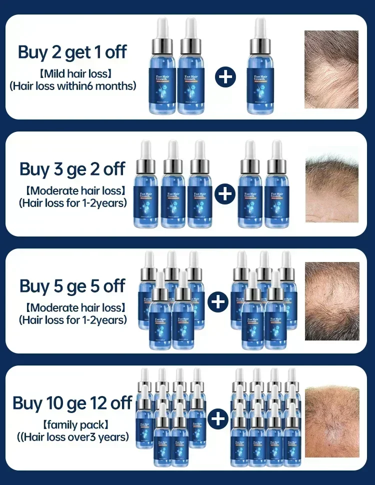 Новинка эффективное быстрое масло для роста волос Sdotter восстановление облысения