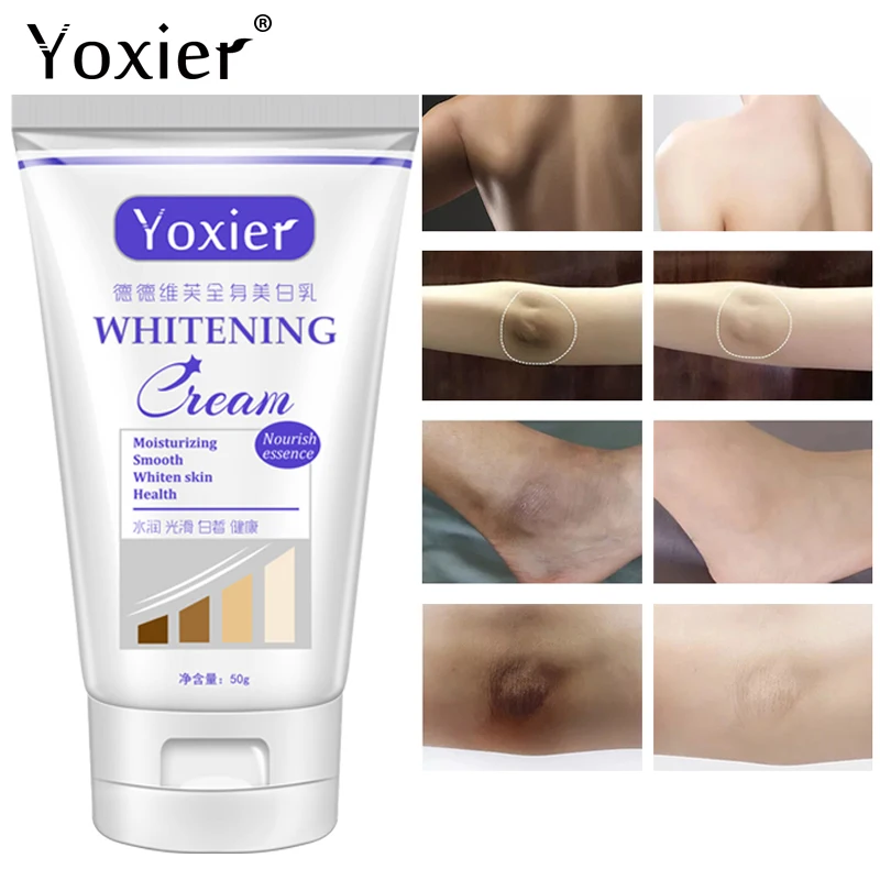 

Отбеливающий крем Yoxier для рук, подмышек, лодыжек, коленей, сосков, частные части, отбеливающий тело, Осветляющий боди уход 50 мл
