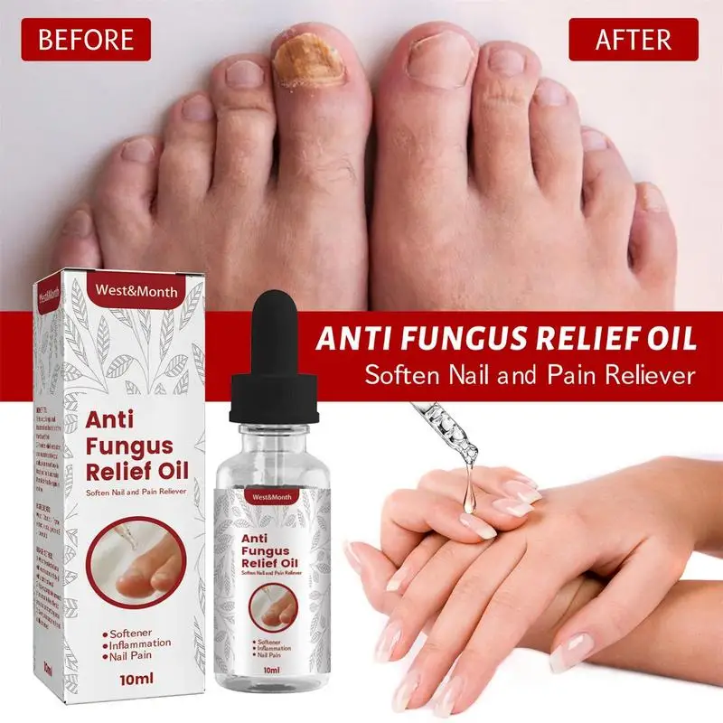 

Toenail Care Nail Conditioner Extra Strength Foot Soak Nail Repair Solution For Smelly Feet Athlete's Foot Cracked And Discolore