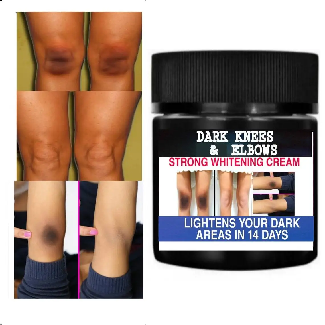 

Dark Knees Lightening Cream, Dark Elbows Cream, Dark Spots Cream